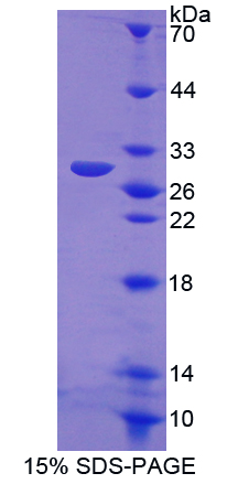 Recombinant Nitric Oxide Synthase 2, Inducible (NOS2)