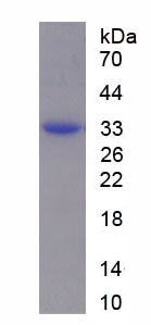 Recombinant Coagulation Factor IX (F9)