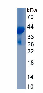 Recombinant Lipoprotein, a (Lpa)