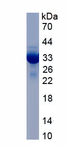 Recombinant Glycogen Phosphorylase, Brain (PYGB)