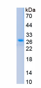 Recombinant Prolactin (PRL)