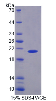 Recombinant Glycogen Phosphorylase, Liver (PYGL)