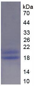 Recombinant Glycogen Phosphorylase, Liver (PYGL)