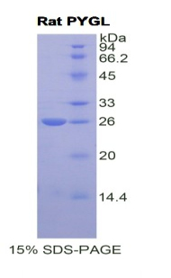 Recombinant Glycogen Phosphorylase, Liver (PYGL)