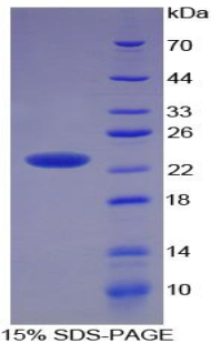 Recombinant Receptor Activator Of Nuclear Factor Kappa B Ligand (RANkL)