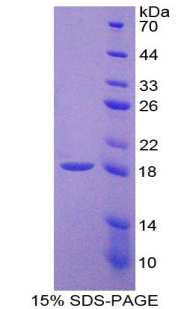 Recombinant Receptor Activator Of Nuclear Factor Kappa B Ligand (RANkL)