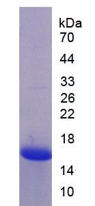 Recombinant Mannose Associated Serine Protease 2 (MASP2)