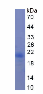 Recombinant Mannose Associated Serine Protease 2 (MASP2)