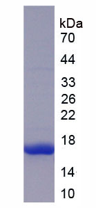 Recombinant Mannose Associated Serine Protease 2 (MASP2)