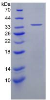 Recombinant Epithelial Neutrophil Activating Peptide 78 (ENA78)