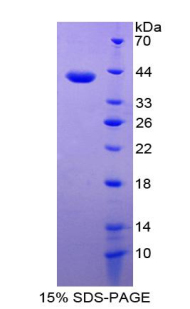 Recombinant Epithelial Neutrophil Activating Peptide 78 (ENA78)