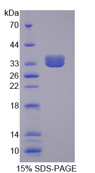 Recombinant Complement Component 3 (C3)