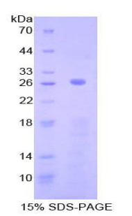 Recombinant Complement Component 2 (C2)