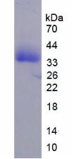 Recombinant Anaplastic Lymphoma Kinase (ALK)