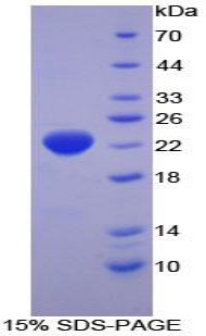 Recombinant Heat Shock Protein Beta 2 (HSPb2)