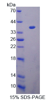 Recombinant Heat Shock Protein 40 (HSP40)