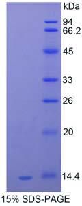 Recombinant Serum Amyloid A (SAA)