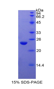 Recombinant Peroxisome Proliferator Activated Receptor Gamma (PPARg)