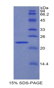 Recombinant Peroxisome Proliferator Activated Receptor Gamma (PPARg)