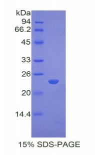 Recombinant Peroxisome Proliferator Activated Receptor Gamma (PPARg)