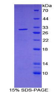 Recombinant Pyruvate Dehydrogenase Phosphatase (PDP)