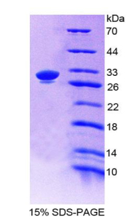 Recombinant Complement Component 4 (C4)