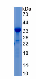 Recombinant Complement Component 4 (C4)