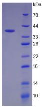 Recombinant Insulin Receptor (INSR)