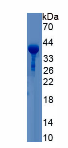 Recombinant Cystatin C (Cys-C)