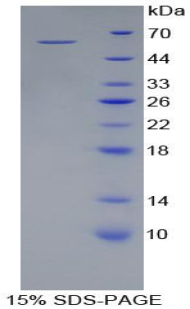 Recombinant Acid Phosphatase 5, Tartrate Resistant (ACP5)