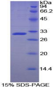 Recombinant Acid Phosphatase 5, Tartrate Resistant (ACP5)