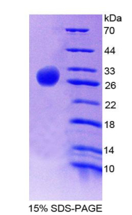 Recombinant Prostaglandin E Synthase 2 (PTGES2)