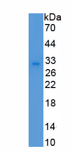 Recombinant Chemokine C-C-Motif Receptor 5 (CCR5)