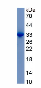 Recombinant Ceruloplasmin (CP)