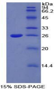 Recombinant Ceruloplasmin (CP)