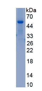 Recombinant Dihydrolipoyl Dehydrogenase (DLD)