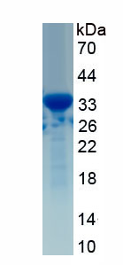 RPA928Hu01.jpg