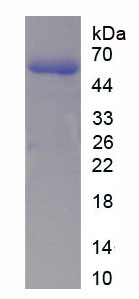 Recombinant Tumor Protein p53 (P53)