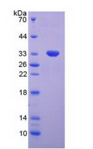 Recombinant Tumor Protein p53 (P53)