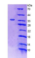 Recombinant Tumor Protein p53 (P53)