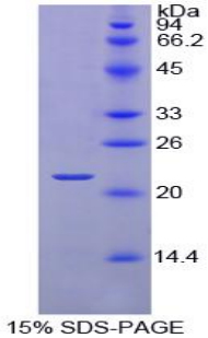 Recombinant Retinol Binding Protein 4 (RBP4)