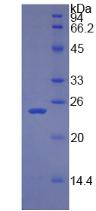 Recombinant Retinol Binding Protein 4 (RBP4)