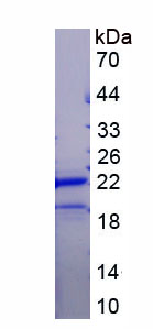 Recombinant Retinol Binding Protein 4 (RBP4)