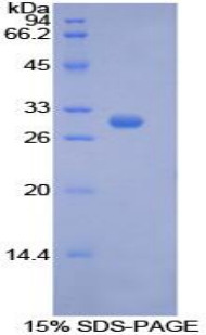 Recombinant Phosphoenolpyruvate Carboxykinase 1, Soluble (PCK1)