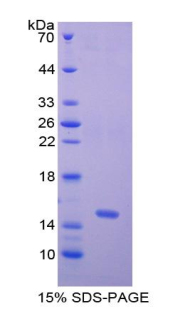 Recombinant Nephrin (NPHN)