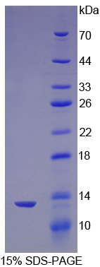 Recombinant Nephrin (NPHN)