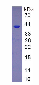 Recombinant Nephrin (NPHN)