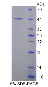 RPA939Hu01.jpg