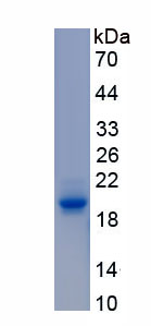 Recombinant Gamma-synuclein (SNCG)