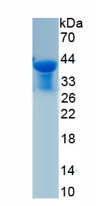 Recombinant Chemokine C-X-C-Motif Receptor 4 (CXCR4)